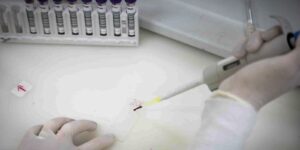secretaria-de-saude-de-sp-investiga-novo-caso-suspeito-de-ebola
